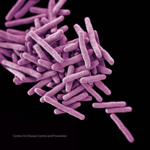 tuberkulosis