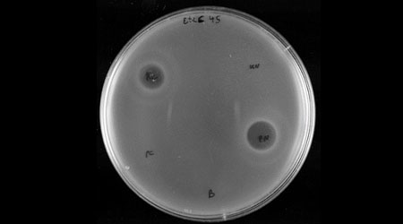 Escherichia coli